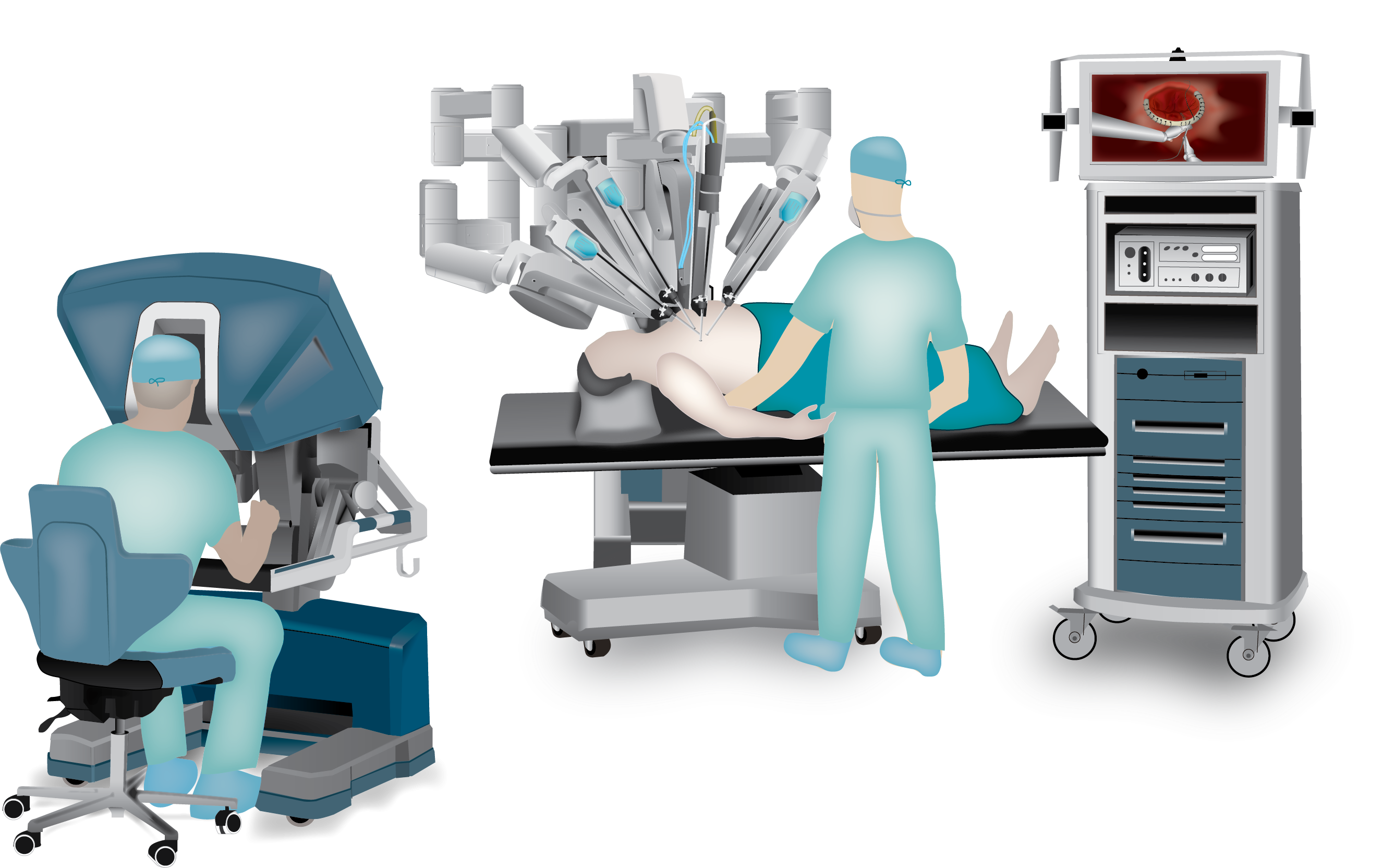 Robotic Heart Surgery | Cardiothoracic
