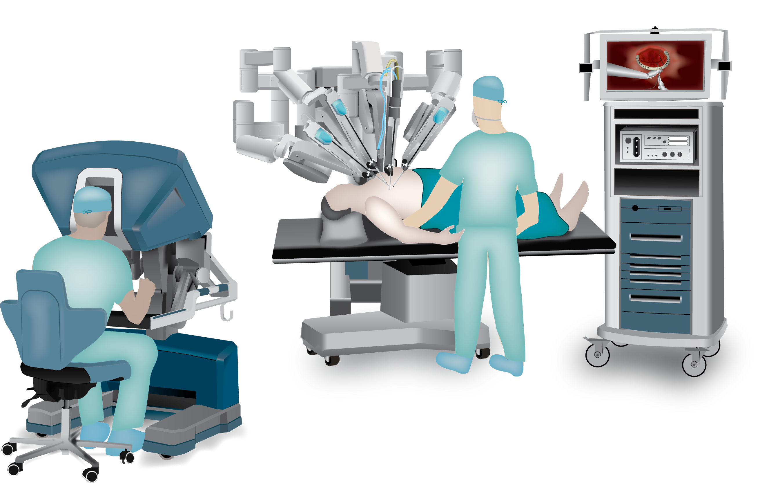 Robotic Heart Surgery Cardiothoracic Surgery