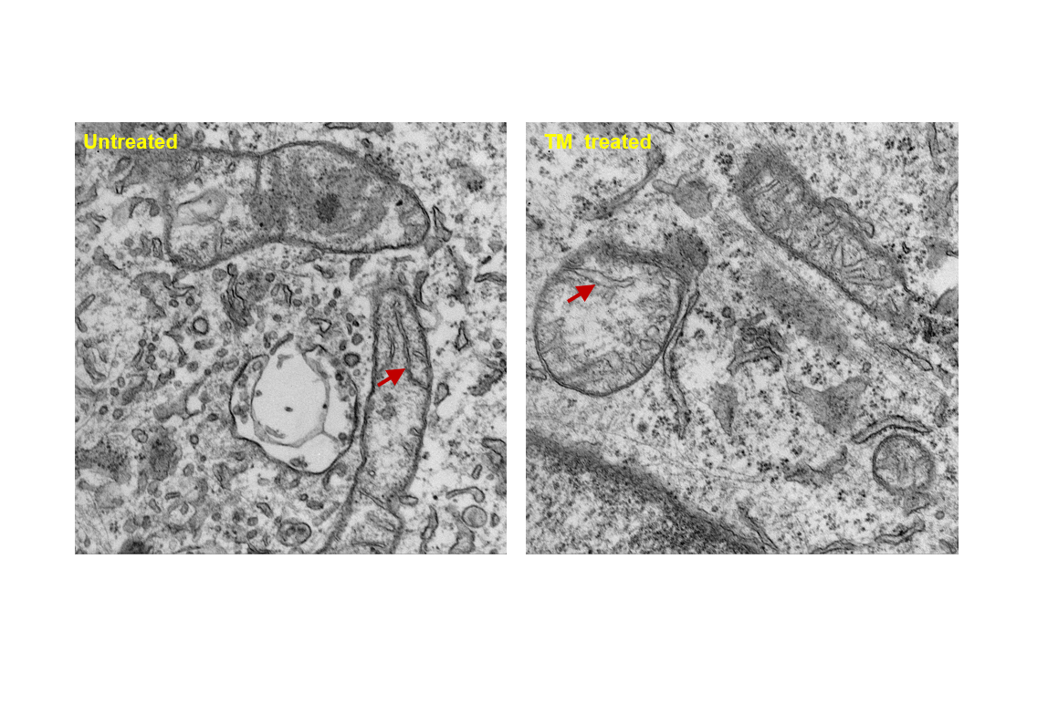 Transmission electron microscopy images